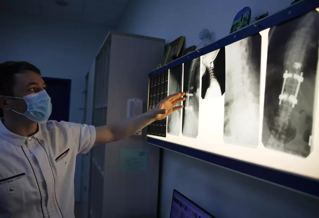 Lekarze diagnozują osteochondrozę szyjki macicy za pomocą metod instrumentalnych, takich jak radiografia